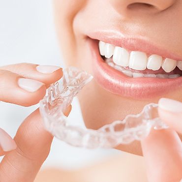 Patientin setzt transparente, herausnehmbarer Aligner in München Bogenhausen ein